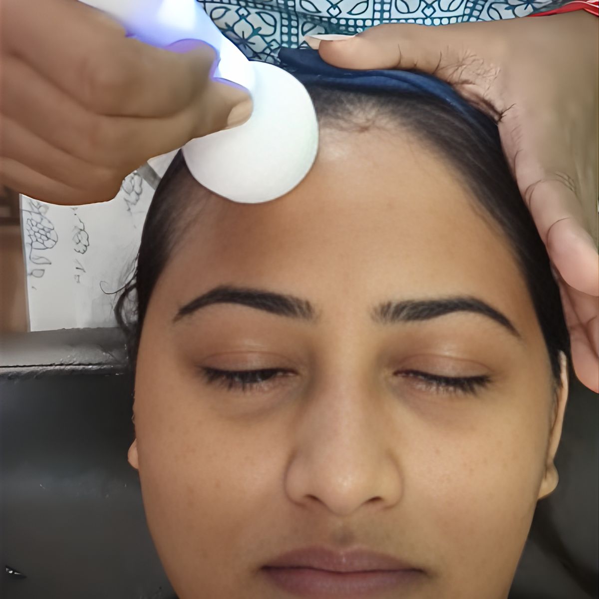 skin treatment​ by parna
